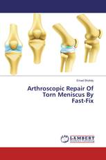 Arthroscopic Repair Of Torn Meniscus By Fast-Fix