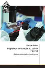 Dépistage du cancer du col de l’utérus