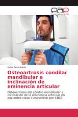 Osteoartrosis condilar mandibular e inclinación de eminencia articular