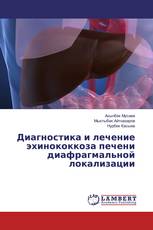 Диагностика и лечение эхинококкоза печени диафрагмальной локализации