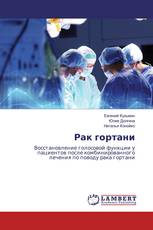 Рак гортани