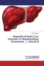 Hepatitis B And C Co-infecton In Hepatocellaur Carcinoma _+ Occult B