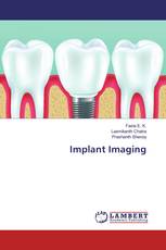 Implant Imaging