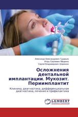 Осложнения дентальной имплантации. Мукозит. Периимплантит