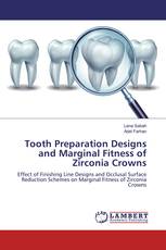 Tooth Preparation Designs and Marginal Fitness of Zirconia Crowns