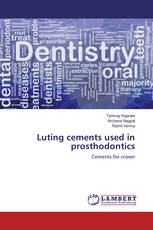 Luting cements used in prosthodontics