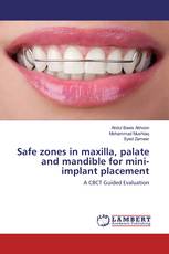 Safe zones in maxilla, palate and mandible for mini-implant placement