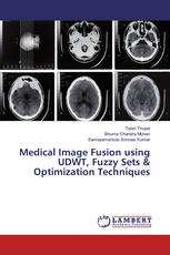 Medical Image Fusion using UDWT, Fuzzy Sets & Optimization Techniques