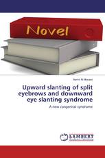 Upward slanting of split eyebrows and downward eye slanting syndrome