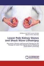 Lower Pole Kidney Stones and Shock Wave Lithotripsy