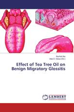 Effect of Tea Tree Oil on Benign Migratory Glossitis