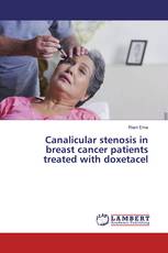 Canalicular stenosis in breast cancer patients treated with doxetacel