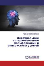 Церебральные артериовенозные мальформации и эпиприступы у детей
