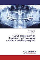 “CBCT assessment of foramina and accessory canals in maxillary region"