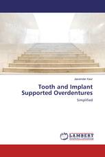 Tooth and Implant Supported Overdentures