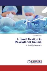 Internal Fixation in Maxillofacial Trauma