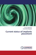 Current status of implants placement