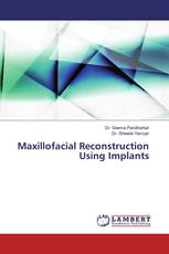 Maxillofacial Reconstruction Using Implants