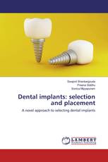 Dental implants: selection and placement