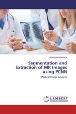 Segmentation and Extraction of MR Images using PCNN