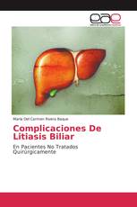 Complicaciones De Litiasis Biliar