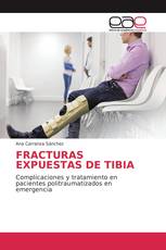 FRACTURAS EXPUESTAS DE TIBIA