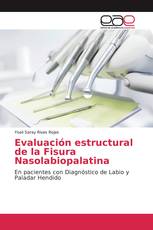 Evaluación estructural de la Fisura Nasolabiopalatina