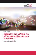 Citoplasma-ANCA en el lupus eritematoso sistémico: