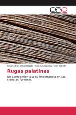 Rugas palatinas
