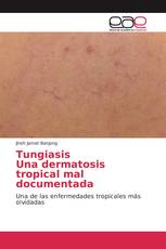 TungiasisUna dermatosis tropical mal documentada
