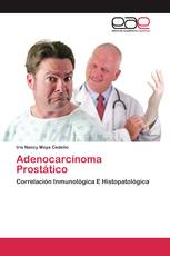 Adenocarcinoma Prostático