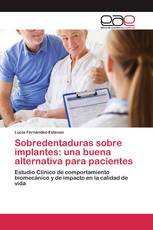 Sobredentaduras sobre implantes: una buena alternativa para pacientes