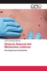 Historia Natural del Melanoma cutáneo