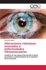 Alteraciones retinianas asociados a enfermedades Vítreomaculares