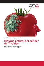 Historia natural del cáncer de Tiroides