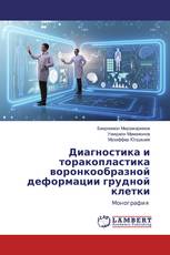 Диагностика и торакопластика воронкообразной деформации грудной клетки
