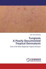 TungiasisA Poorly Documented Tropical Dermatosis
