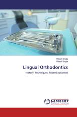 Lingual Orthodontics