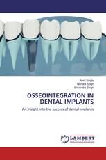 OSSEOINTEGRATION IN DENTAL IMPLANTS