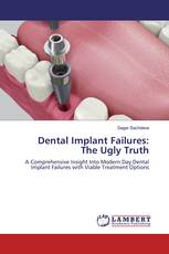 Dental Implant Failures:The Ugly Truth