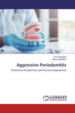 Aggressive Periodontitis