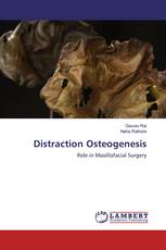 Distraction Osteogenesis