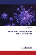 Microflora in failed root canal treatment