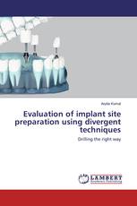 Evaluation of implant site preparation using divergent techniques