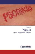 Psoriasis