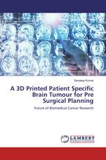 A 3D Printed Patient Specific Brain Tumour for Pre Surgical Planning