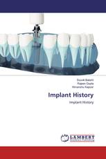 Implant History