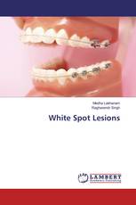 White Spot Lesions