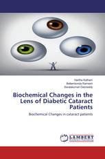 Biochemical Changes in the Lens of Diabetic Cataract Patients