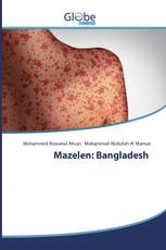 Mazelen: Bangladesh